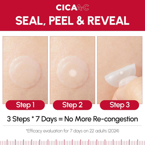 Dermafirm CICA A.C Spot Patch - Korean Skin Care Pimple Patches for Face w/Centella Asiatica - Invisible Vegan Hydrocolloid Pimple Patches - Water Resistant Hydrocolloid 10mm & 12mm (99EA)