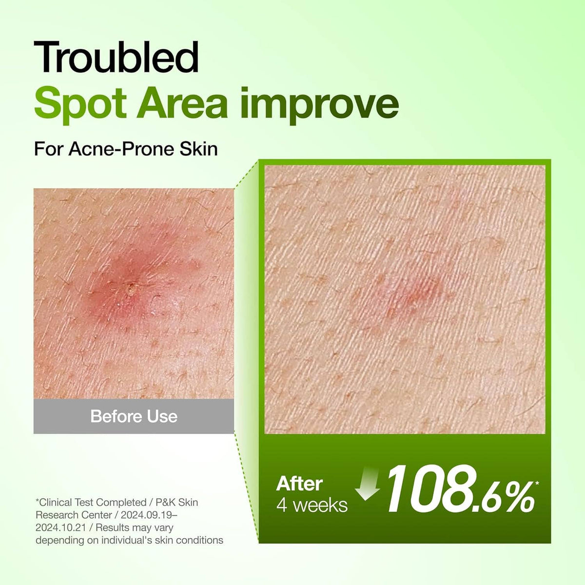 Anua Azelaic 10 Hyaluron Redness Soothing Pads